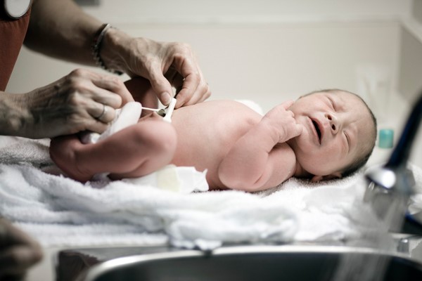 Омфалит у новорожденного, фото